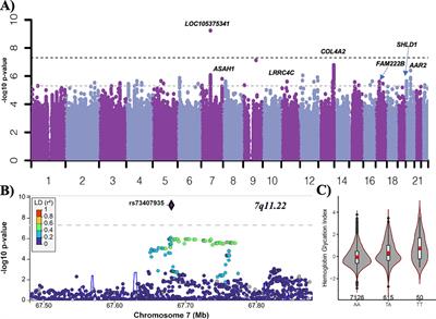 A genome-wide association study identifies genetic determinants of hemoglobin glycation index with implications across sex and ethnicity